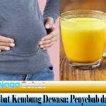 Obat Kembung Dewasa: Penyebab dan Gejala